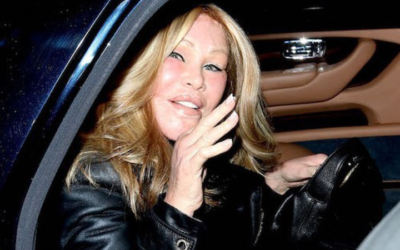Muere en París Jocelyn Wildenstein, la famosa “mujer gato”