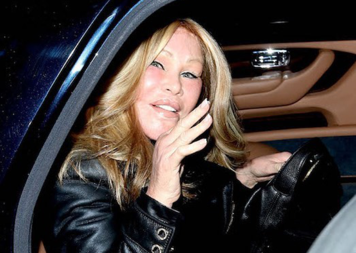 Muere en París Jocelyn Wildenstein, la famosa “mujer gato”